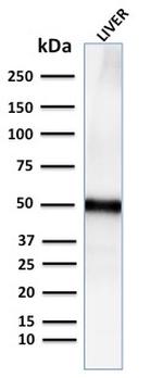 Adipophilin/Perilipin-2 Antibody in Western Blot (WB)