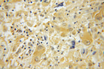 ACYP2 Antibody in Immunohistochemistry (Paraffin) (IHC (P))