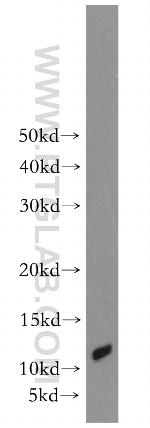 ACYP2 Antibody in Western Blot (WB)