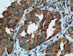 PDCD6 Antibody in Immunohistochemistry (Paraffin) (IHC (P))