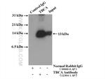 TBCA Antibody in Immunoprecipitation (IP)