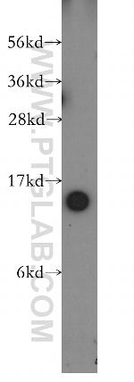 TBCA Antibody in Western Blot (WB)