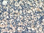 ZFP36L1 Antibody in Immunohistochemistry (Paraffin) (IHC (P))