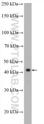 ZFP36L1 Antibody in Western Blot (WB)