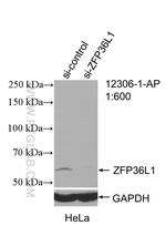 ZFP36L1 Antibody in Western Blot (WB)