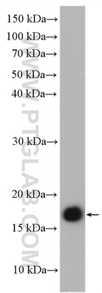 GEMIN6 Antibody in Western Blot (WB)