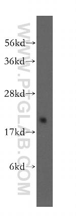 GEMIN6 Antibody in Western Blot (WB)