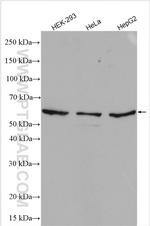 HRPT2 Antibody in Western Blot (WB)