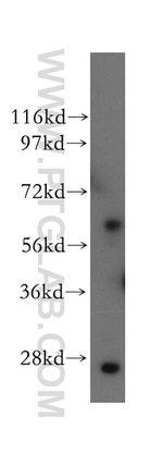 HRPT2 Antibody in Western Blot (WB)