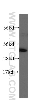 GNPDA1 Antibody in Western Blot (WB)