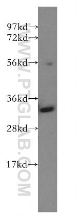 GNPDA1 Antibody in Western Blot (WB)