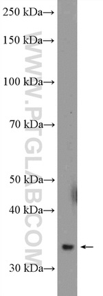 GNPDA1 Antibody in Western Blot (WB)