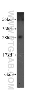 RAB3D Antibody in Western Blot (WB)