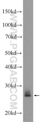 RAB3D Antibody in Western Blot (WB)