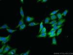 RAB3IP/Rabin8 Antibody in Immunocytochemistry (ICC/IF)