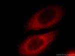 RAB3IP/Rabin8 Antibody in Immunocytochemistry (ICC/IF)