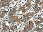 RAB3IP/Rabin8 Antibody in Immunohistochemistry (Paraffin) (IHC (P))