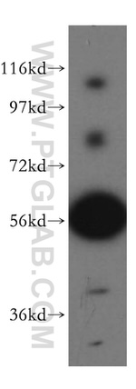 RAB3IP/Rabin8 Antibody in Western Blot (WB)