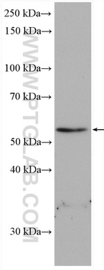 RAB3IP/Rabin8 Antibody in Western Blot (WB)