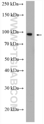 SCYL2 Antibody in Western Blot (WB)