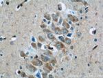 TWSG1 Antibody in Immunohistochemistry (Paraffin) (IHC (P))