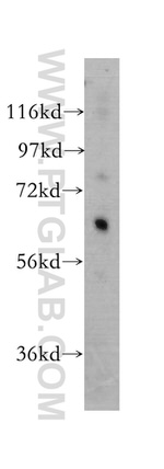 ARSG Antibody in Western Blot (WB)