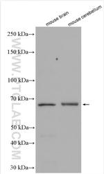 ARSG Antibody in Western Blot (WB)