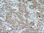 NUP98-NUP96 Antibody in Immunohistochemistry (Paraffin) (IHC (P))