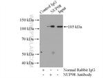 NUP98-NUP96 Antibody in Immunoprecipitation (IP)