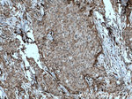 NUP98-NUP96 Antibody in Immunohistochemistry (Paraffin) (IHC (P))