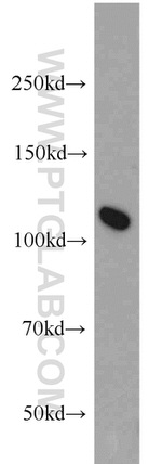 NUP98-NUP96 Antibody in Western Blot (WB)