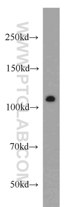 NUP98-NUP96 Antibody in Western Blot (WB)