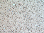 TAK1 Antibody in Immunohistochemistry (Paraffin) (IHC (P))