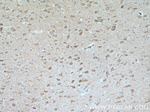 TAK1 Antibody in Immunohistochemistry (Paraffin) (IHC (P))