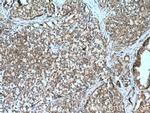 TAK1 Antibody in Immunohistochemistry (Paraffin) (IHC (P))