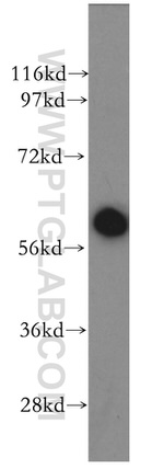 TAK1 Antibody in Western Blot (WB)