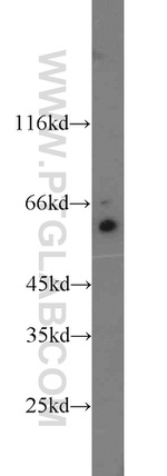 TAK1 Antibody in Western Blot (WB)