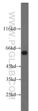 TAK1 Antibody in Western Blot (WB)