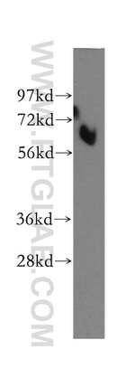 TAK1 Antibody in Western Blot (WB)