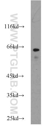 TAK1 Antibody in Western Blot (WB)