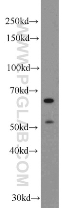 TAK1 Antibody in Western Blot (WB)