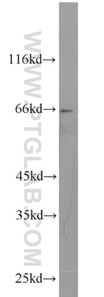 TAK1 Antibody in Western Blot (WB)