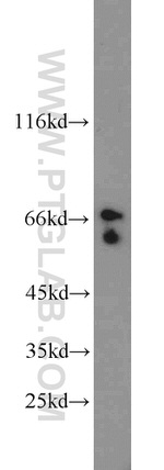 TAK1 Antibody in Western Blot (WB)