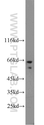 TAK1 Antibody in Western Blot (WB)