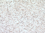 ASH2L Antibody in Immunohistochemistry (Paraffin) (IHC (P))