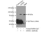 ASH2L Antibody in Immunoprecipitation (IP)