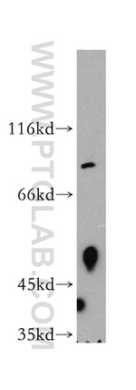 ASH2L Antibody in Western Blot (WB)