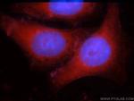 IDH1 Antibody in Immunocytochemistry (ICC/IF)