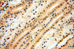 IDH1 Antibody in Immunohistochemistry (Paraffin) (IHC (P))