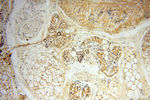 IDH1 Antibody in Immunohistochemistry (Paraffin) (IHC (P))